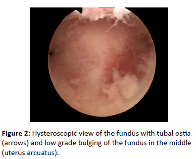 contraceptivestudies-Hysteroscopic-view